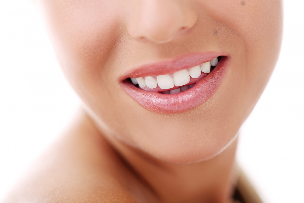 Sourire aux dents blanches et alignées