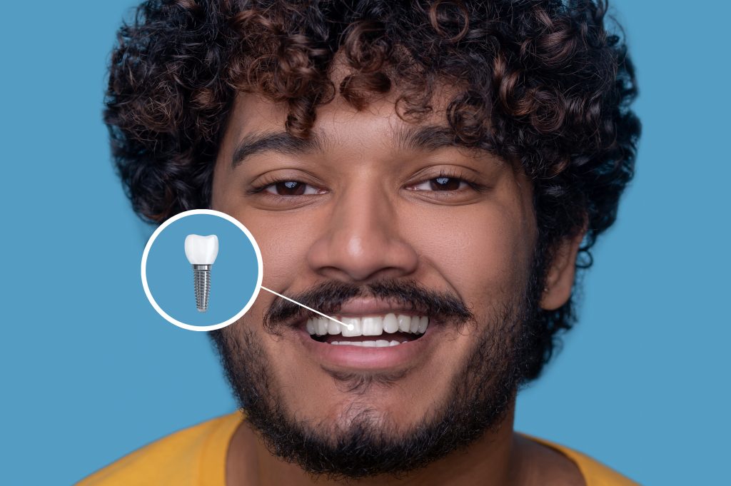Homme souriant avec un implant dentaire