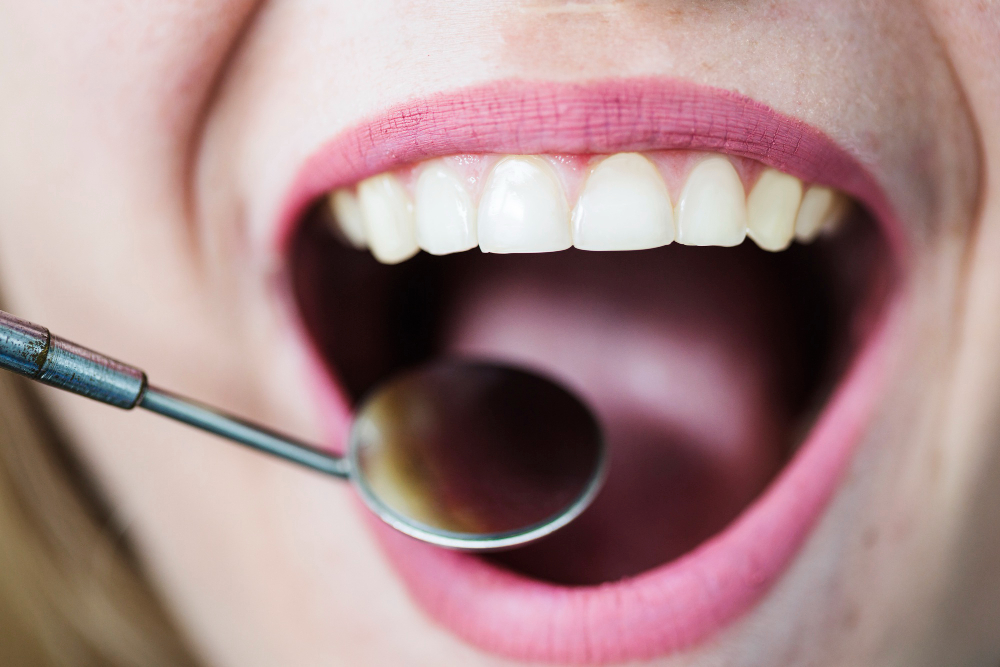 Examen des dents et des gencives au miroir dentaire